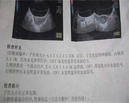 北京助孕论坛，专业一对一服务