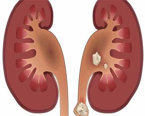 广西代生孩子，2026
广西壮族自治区生殖医院做一个试管婴儿男孩费用多少钱