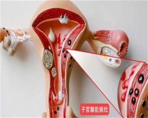 正规供卵试管中心价格表，厦门代生供卵医院