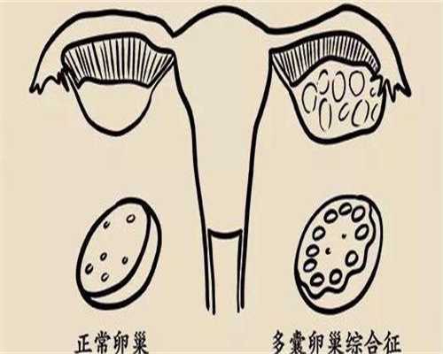 输卵管堵塞要怎么调理