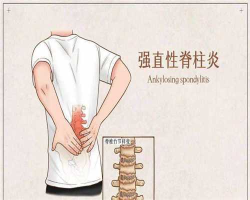 广西试管供卵价格，广西壮族自治区南溪山医院试管婴儿多少钱贵吗