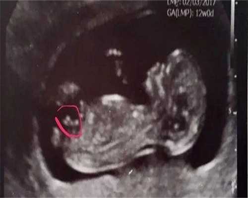 广西包生男孩吗，广西壮族自治区人民医院做试管婴儿多少钱？一次费用多少？