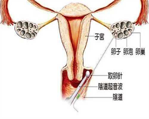 武汉助孕生孩子，武汉试管助孕医院