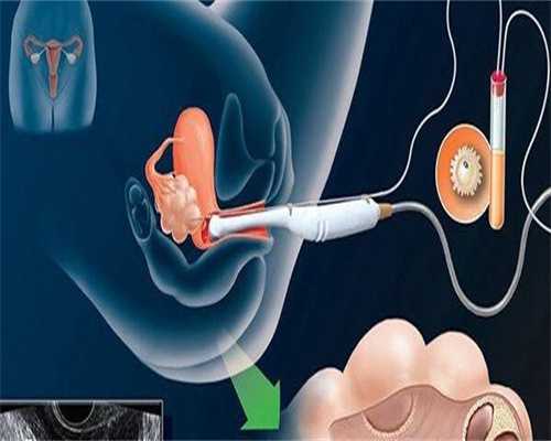 云南助孕公司官方，云南做试管婴儿能生男孩吗？去云南做试管生男孩怎么样？