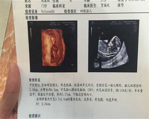 广西借卵试管卵妹，广西壮族自治区南溪山医院试管婴儿多少钱贵吗