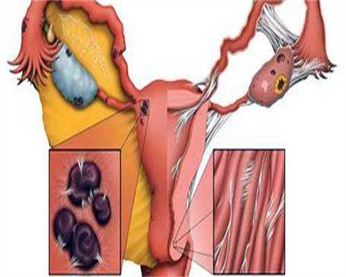 大龄妈二胎隐患完善备孕5步走