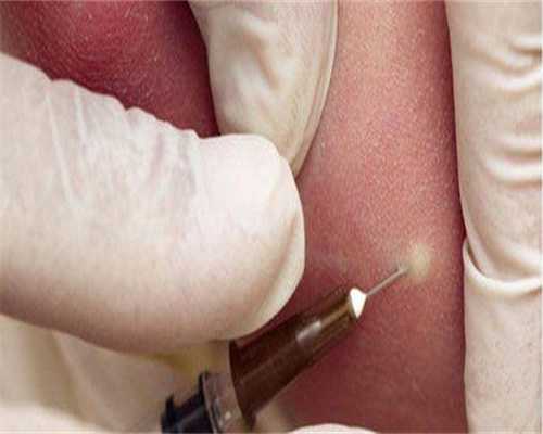 广西供卵医院联系方式电话