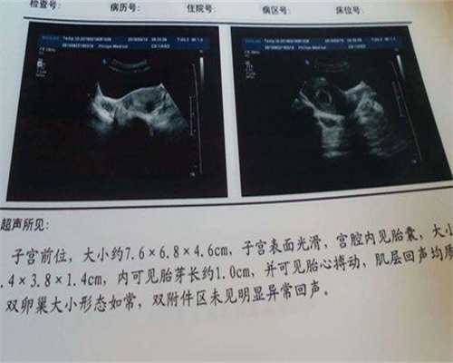 广西代生专业吗,广西壮族自治区人民医院做试管包生男孩费用一览?