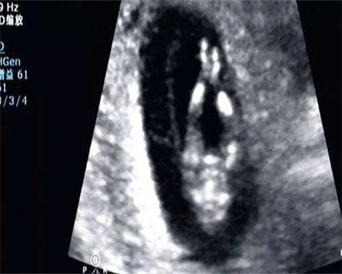 长沙大型助孕机构，长沙高龄助孕私立机构详解