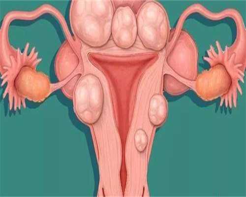 广西怎么做供卵,广西梧州工人医院借卵试管费用清单一览!