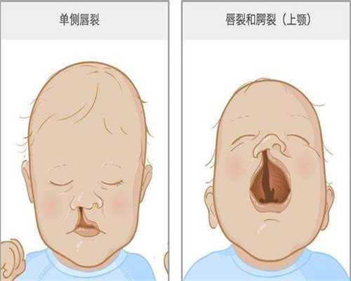 河南助孕包龙凤胎，河南省最新产假规定