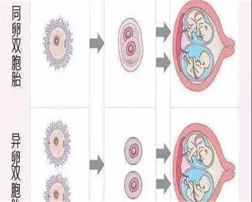 广西自卵代怀,广西壮族自治区人民医院做试管包生男孩费用一览?