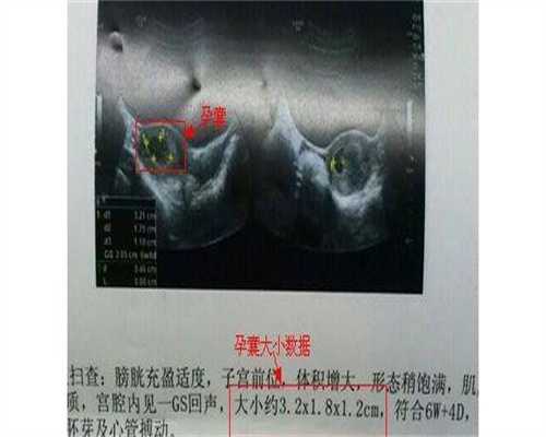广西借卵费用，广西壮族自治区人民医院生殖中心