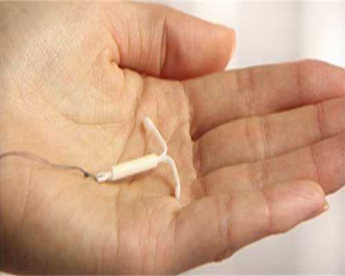 微刺激方案可以移植鲜胚吗（微刺激方案鲜胚移植）