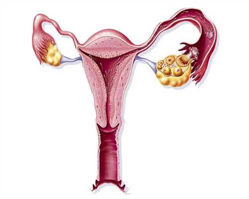 失独家庭做试管婴儿有一次性补助吗