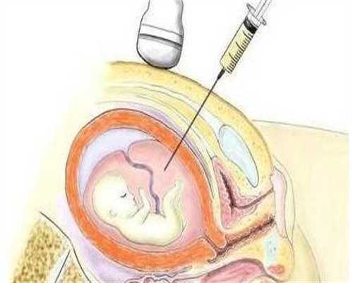 佛山有喜助孕中心,佛山月子中心加盟条件