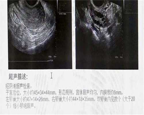 广西供卵包男孩价格,安徽试管包生男孩价格贵吗?安徽试管包生男孩费用