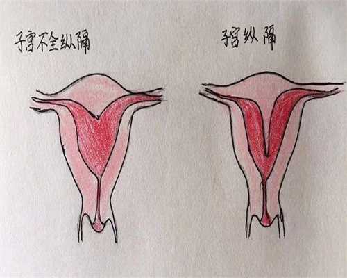 供卵试管移植囊胚，什么是供卵试管？