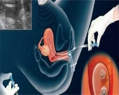 南昌供卵试管婴儿医院排名最好？