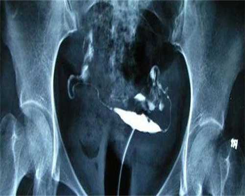 卵子储存和胚胎储存别混为一谈,卵子储存和胚胎储存的区别